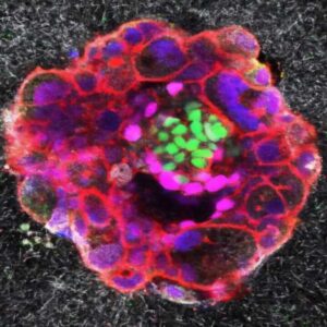 kisirlik derdine umut oldu embriyosunun rahme yerlesme ani ilk kez goruntulendi hXGuRHvG